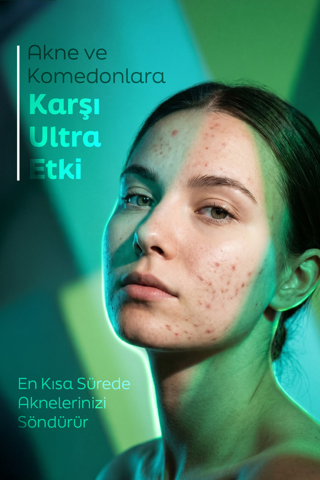 Akne Komedon Siyah Nokta Karşıtı Serum Salisilik Asit Glikolik Asit İçerikli 30 ML